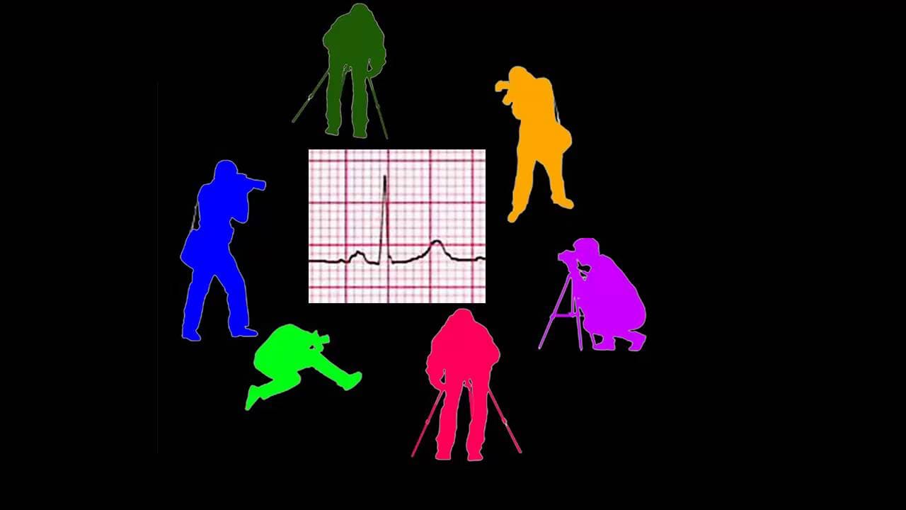 CURSO DE ELECTROCARDIOGRAFIA 05 - LA RAZÓN DE SER DE LAS DERIVACIONES ELECTROCARDIOGRÁFICAS